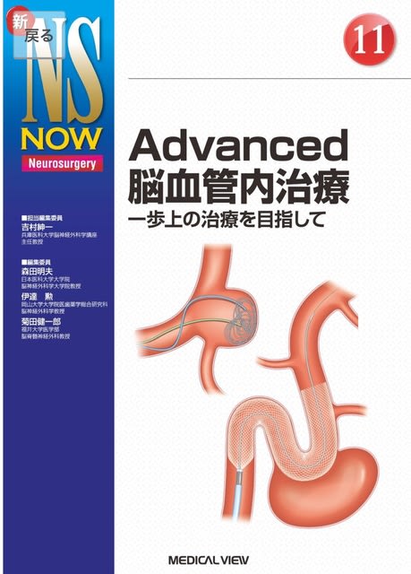 Advanced脳血管内治療