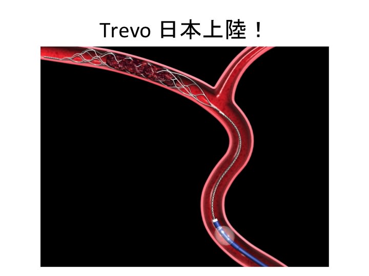 Trevo国内初症例！