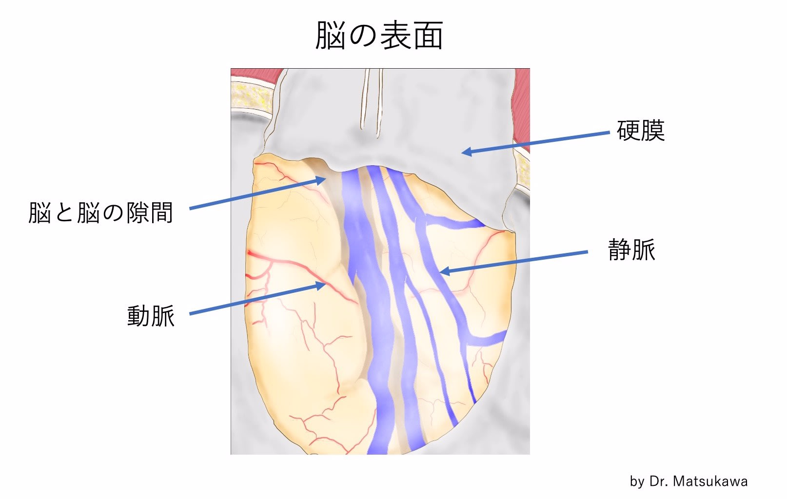 脳動脈瘤 その19 外科手術 1. クリッピング術 「脳の表面はどうなっている?」