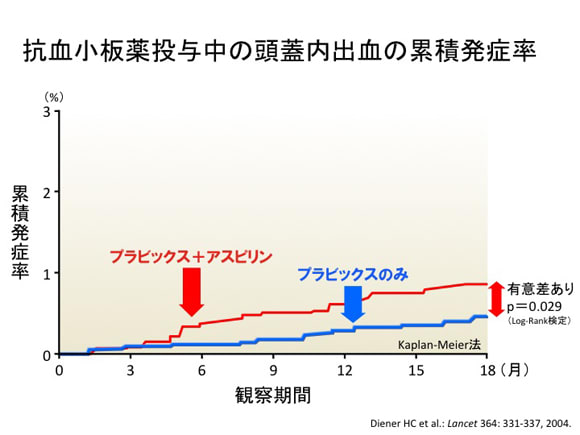 アスピリンとプラビックスの併用の問題点