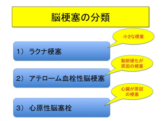 脳梗塞慢性期の治療　はじめに