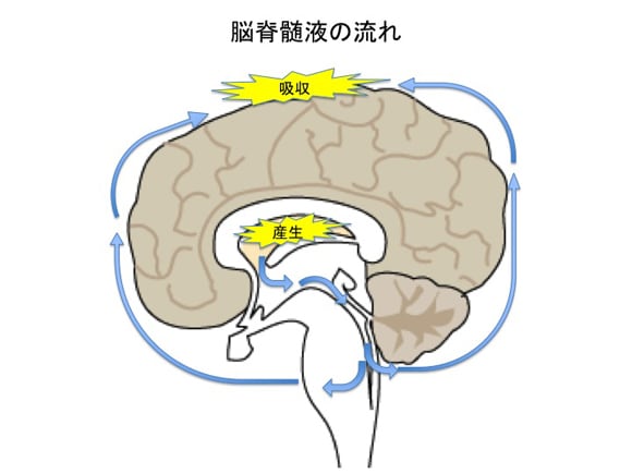 水頭症 その1