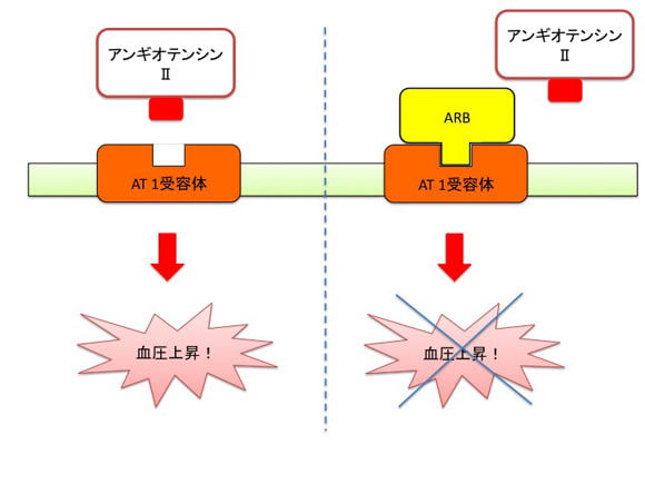 アンギオテンシンII受容体ブロッカー(ARB)