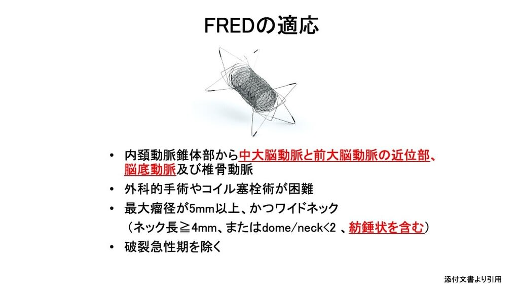 脳動脈瘤 その50 脳血管内治療:その20 フローダイバーター FREDの適応