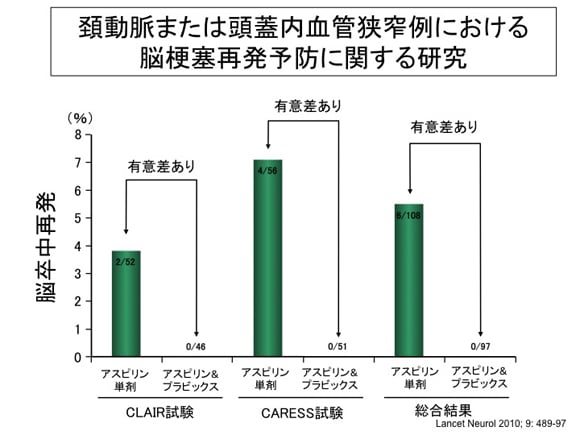 アスピリンとプラビックスの併用について