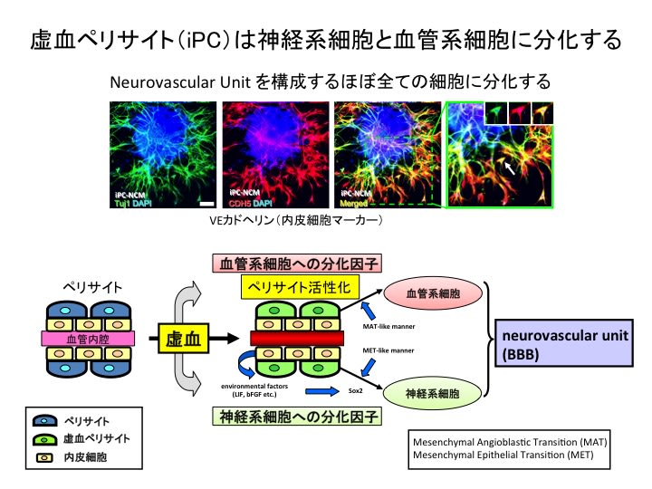 新たな脳梗塞治療法の開発