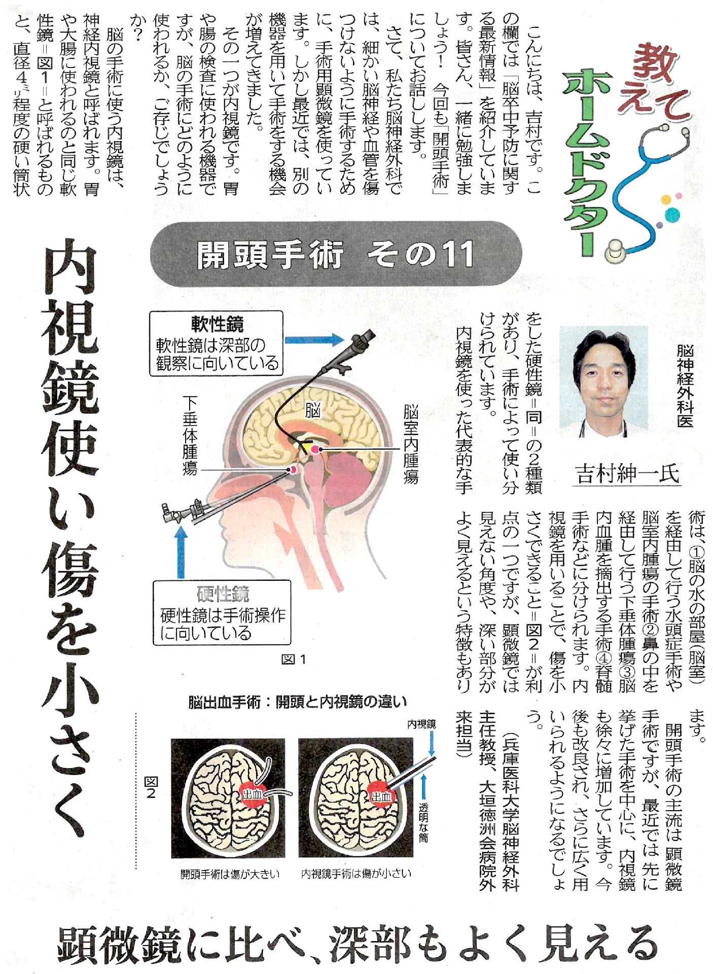 神経内視鏡