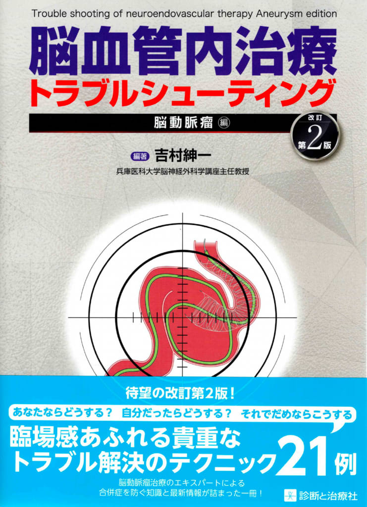 脳血管内治療トラブルシューティング 脳動脈瘤編　第２版！