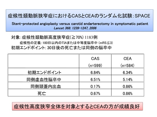 頚動脈ステント留置術のランダム化研究：SPACE