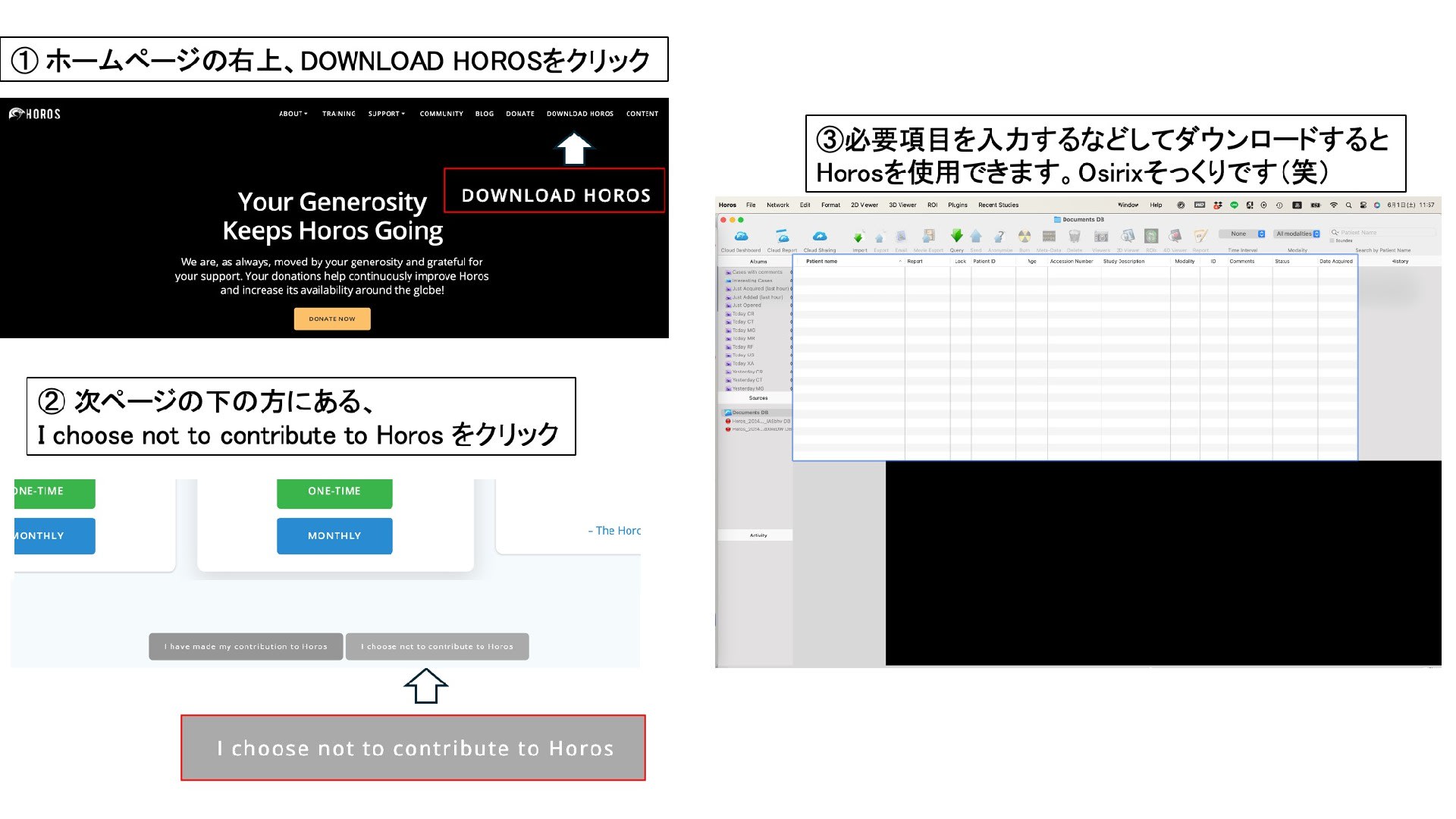 Dicom画像を見るソフトウェア OsirixとHoros