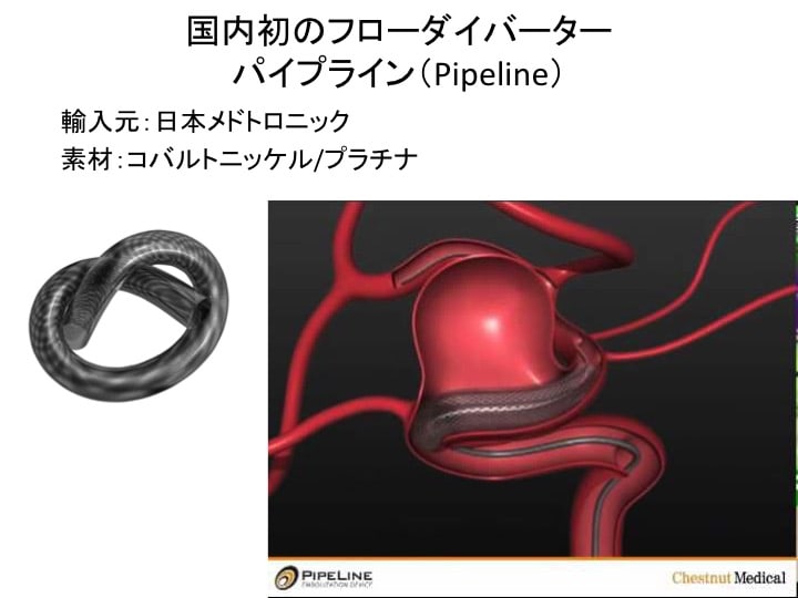 フローダイバーター