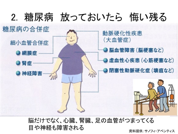 脳卒中にならない５か条　その三「危うきを避け」糖尿病