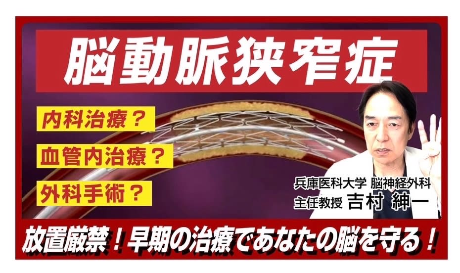 You tube 第12弾 脳動脈狭窄症　脳の血管が細いと言われたらどうする？