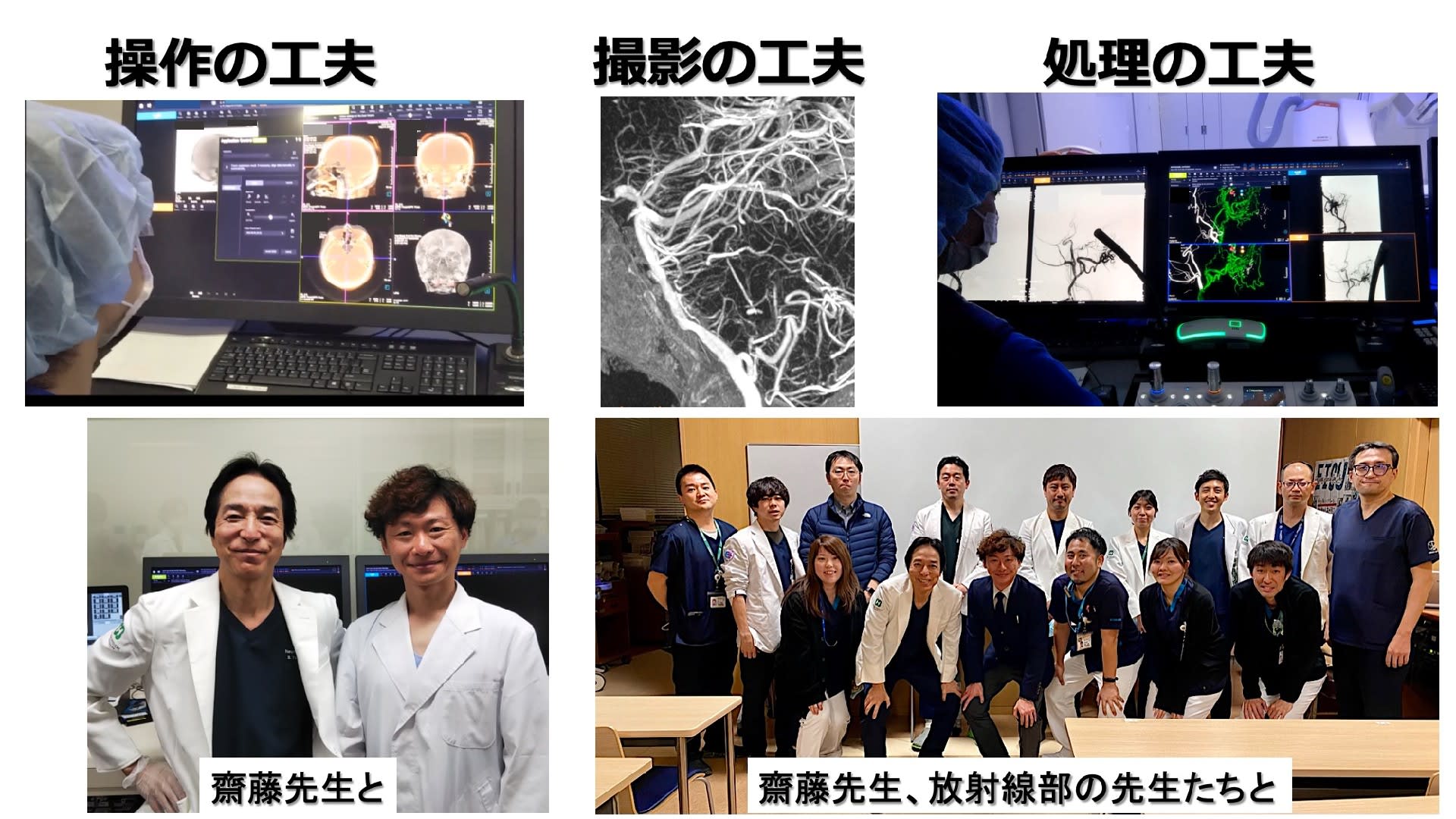 脳血管撮影法の工夫:齋藤 誠先生を招いて