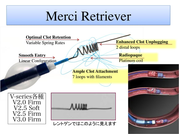 Merciの威力