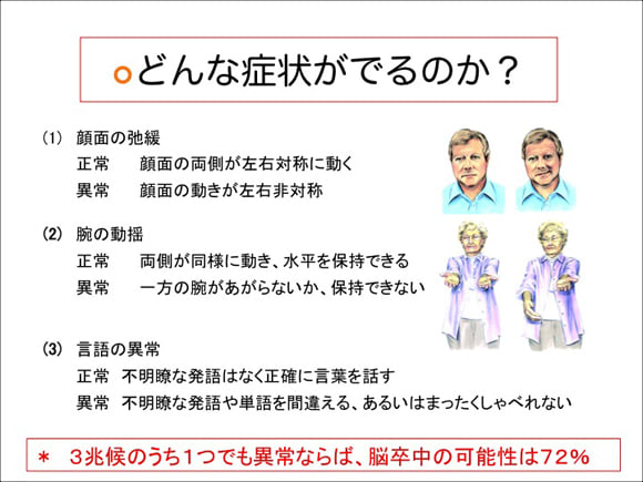 脳卒中にならない5か条 その一「敵を知り」:どんな症状が出るのか?
