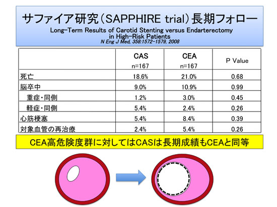 CASの長期成績は? サファイア研究より