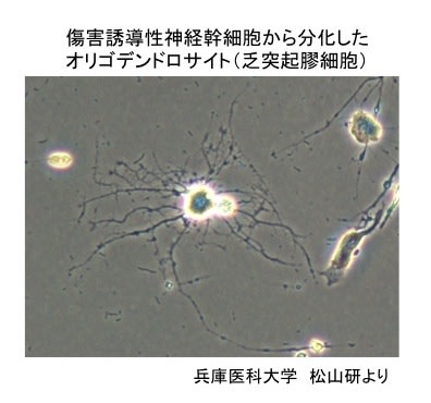 脳梗塞に対する細胞治療