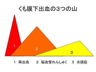 くも膜下出血ー術後管理