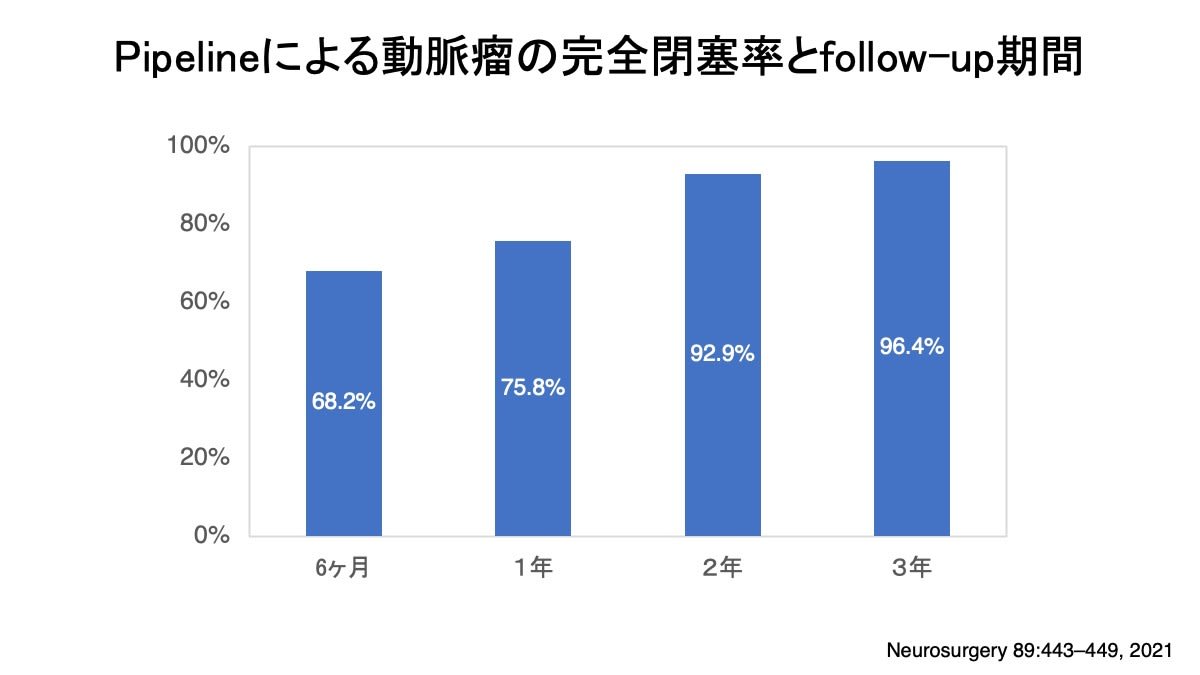 脳動脈瘤 その47 脳血管内治療：その17 フローダイバーター Pipelineの長期治療成績