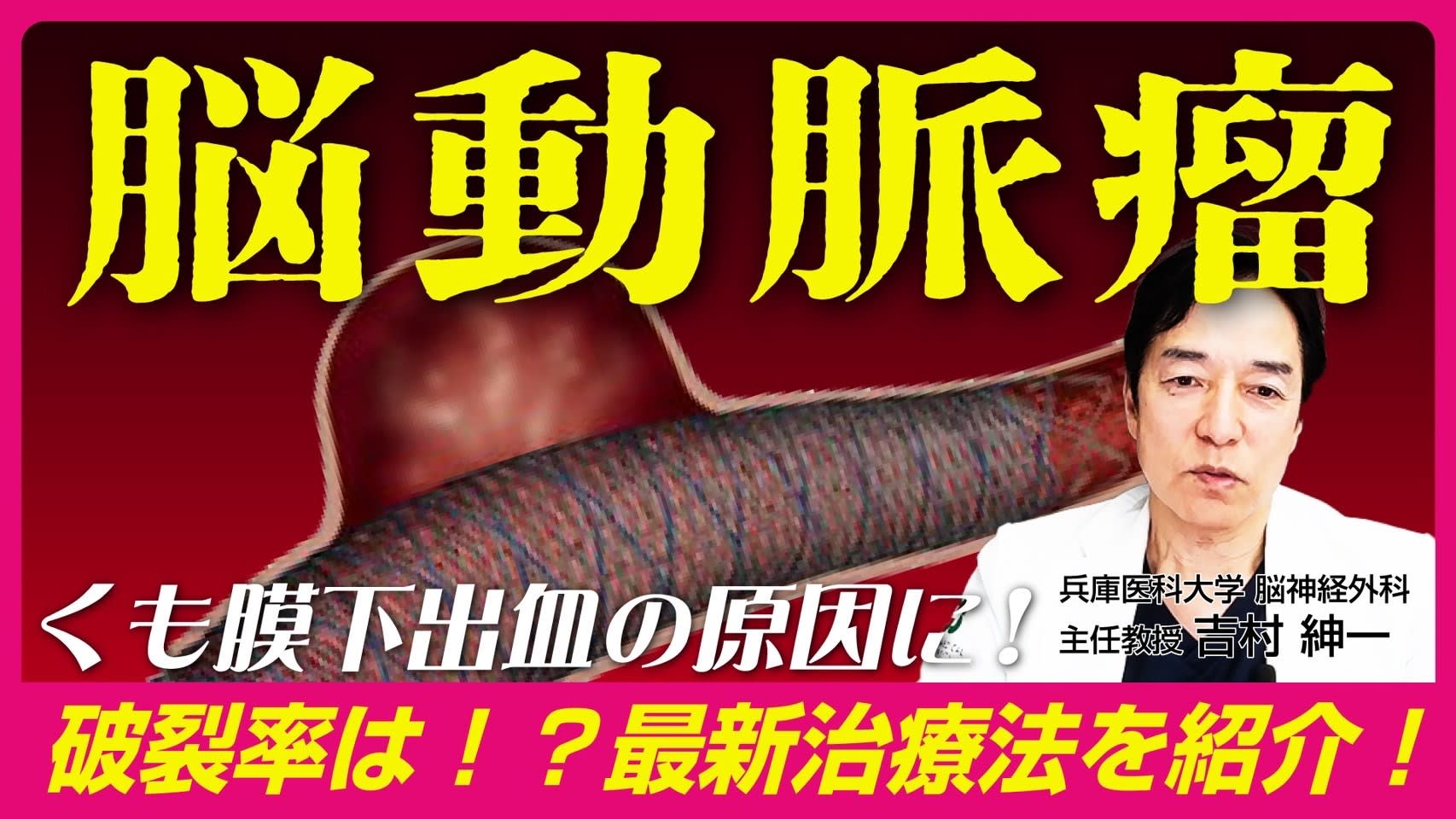 You tube 第10弾 未破裂脳動脈瘤　破裂率は？　最新治療法を紹介！